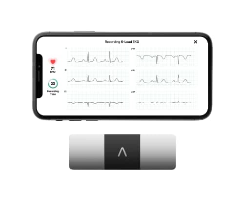 6-Lead EKG Monitor