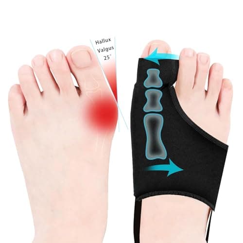 The Best Bunion Splints