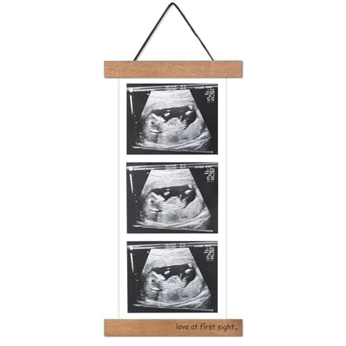 Magnetic Ultrasound Hanger