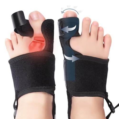 Active Correction Splint